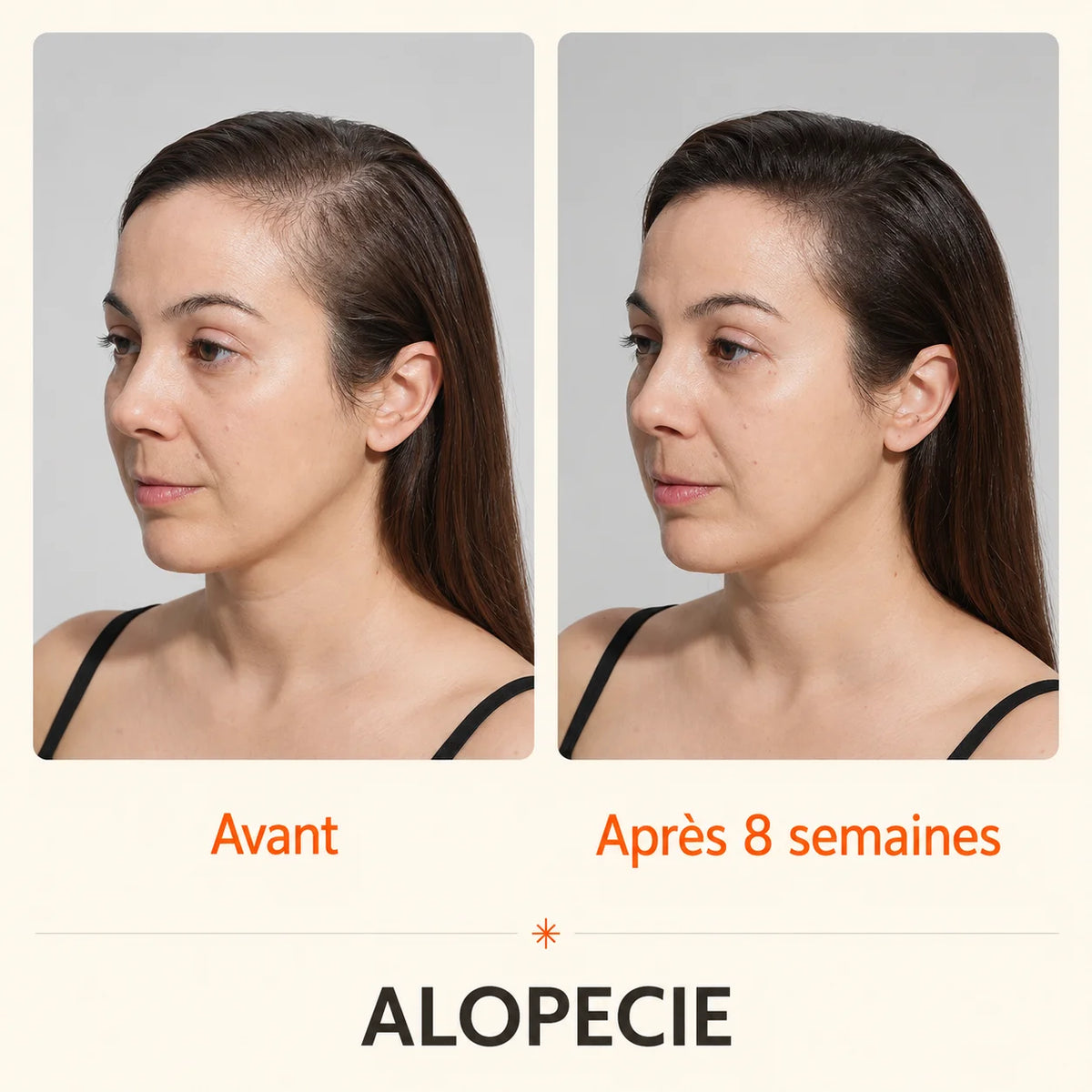 Sérum Capillaire Croissance et Densité