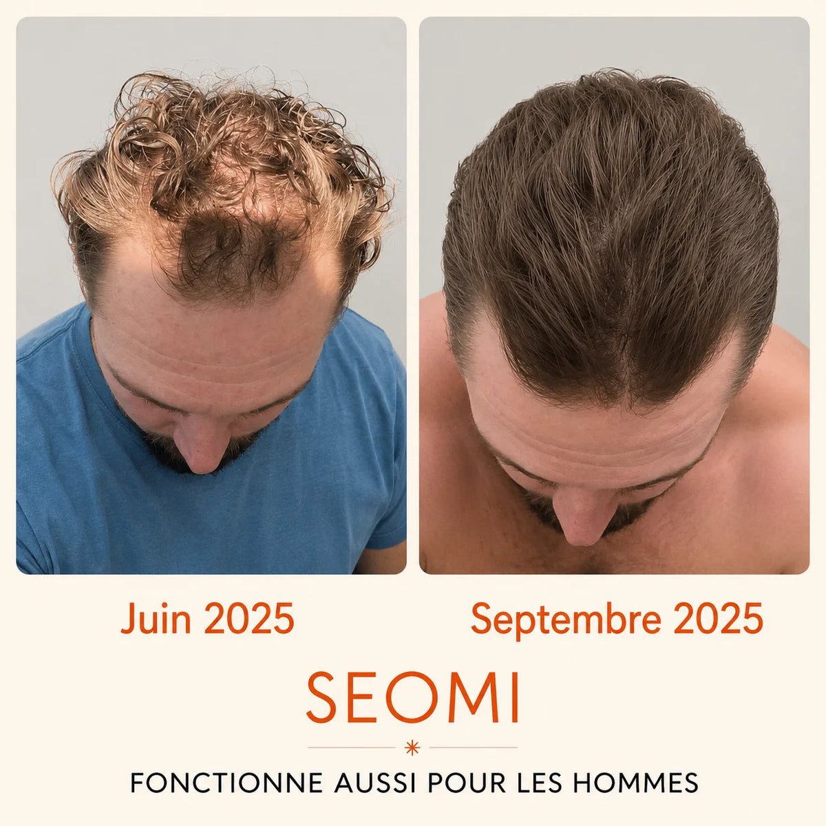 Sérum Capillaire Croissance et Densité