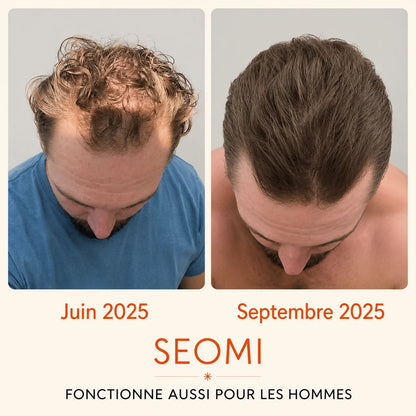 Sérum Capillaire Croissance et Densité