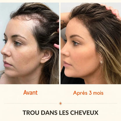 Sérum Capillaire Croissance et Densité