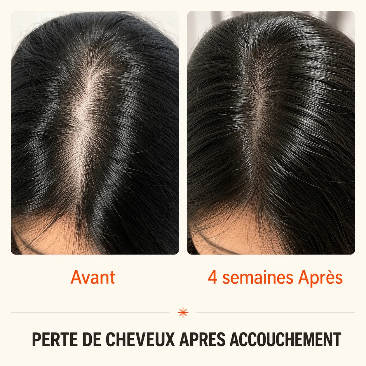 Sérum Capillaire Croissance et Densité